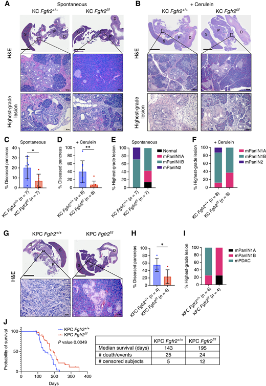 FGFR2 inactivation delays KRASG12D-driven pancreatic tumorigenesis. A and B, Representative hematoxylin and eosin (H&E) staining of the pancreata and highest-grade lesions from 7- to 11-month-old age-matched KC Fgfr2+/+ and Fgfr2f/f mice (n = 7; A) or from age-matched KC Fgfr2+/+ and Fgfr2f/f mice 30 days after cerulein treatment (day −1, day 0; n = 8; B). Scale bars are 4 mm for pancreas images, 100 μm for insets, and 50 μm for the highest-grade lesion images. D, duodenum; P, pancreas; S, spleen. C and D, Quantification of the fraction of diseased pancreas. The results show the mean ± SD. Unpaired Student t test. E and F, Classification of highest-grade lesions. G, Representative hematoxylin and eosin staining of the pancreata and highest-grade lesions from 4-month-old KPC Fgfr2+/+ and Fgfr2f/f mice (n = 4). Scale bars are 5 mm for pancreas images and 50 μm for insets. H, Quantification of the fraction of diseased pancreas. The results show the mean ± SD. Unpaired Student t test. I, Classification of highest-grade lesions. mPDAC, metastatic PDAC. J, Kaplan–Meier survival curve of percent survival for KPC Fgfr2+/+ (n = 25) and KPC Fgfr2f/f (n = 24) mice. Notches represent enrolled mice that died from causes other than tumor (i.e., lymphoma and papilloma). Log-rank Mantel–Cox test. Table of median survival (days). *, P ≤ 0.05; **, P ≤ 0.01. 