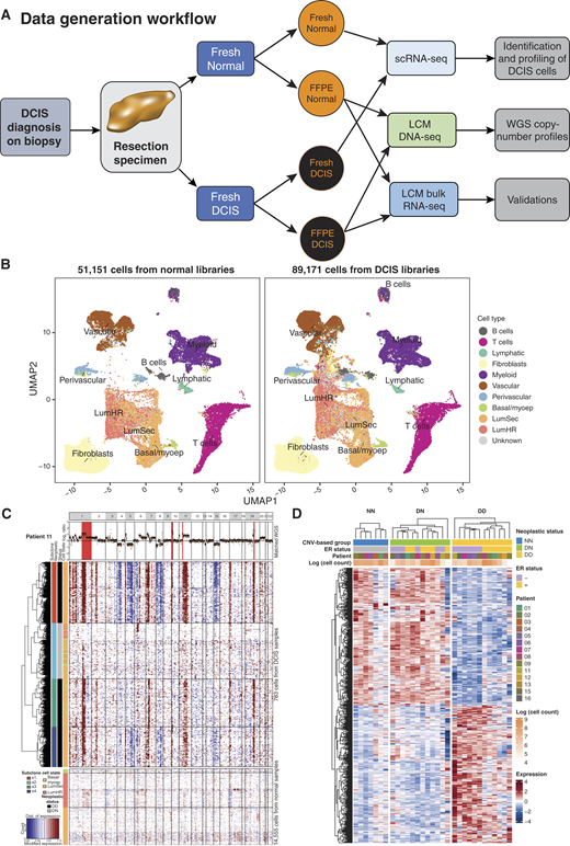 Overview of workflow. A, Laboratory workflow to obtaining multimodal sequencing data from resected specimens (sample set 1) to infer cell phenotypes from scRNA and DNA data and infer cell fractions from specimen-matched bulk RNA data for downstream analyses. LCM, laser capture microdissection. B, UMAP embedding plots based on single-cell transcriptome profiles from 140,322 cells across 13 DCIS sample libraries (89,171 cells) and 7 normal breast sample libraries (51,151 cells) obtained from 14 patients. Data integration and dimension reduction was performed on the entire collection of cells to identify 11 primary cell types. After performing the embedding analysis on the latter, the cells were split depending on whether they were derived from a normal breast sample or DCIS sample library. The inferred cell type was used to color each coordinate. For each cell type, the ID is labeled at the median position of all cells in that category. C, A representative example of patient tumor-matched copy-number motifs inferred from a low-pass WGS (top) and inferred from single-cell DCIS (middle) libraries. A panel of seven normal libraries was used as the reference (bottom). D, Relative expression of pseudobulk samples of epithelial cells from DCIS libraries inferred to be either DD (17,044 cells from 12 pseudobulk samples) or DN (14,309 cells from 12 pseudobulk samples) and cells from normal samples (NN, 14,555 cells from seven pseudobulk samples). The top 250 upregulated and 250 downregulated differentially expressed genes (from DESeq2) ranked by adjusted P value between DD and NN are displayed with expression of DN pseudobulk samples shown for comparison. Color bars indicate neoplastic status (DD, DN, or NN), ER status (DD and DN pseudobulk samples only), patient ID, and cell count (natural log scale).