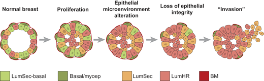 Conceptual model of DCIS invasion. Hypothesized changes in epithelial cell fractions during disease progression from normal breast to early and late DCIS stages.