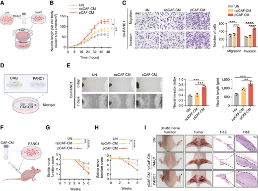The role of pCAFs in promoting neural invasion in pancreatic cancer. A, Schematic illustration of the Transwell coculture system for neuronal and tumor cells. Tumor cells were pretreated with fibroblast-derived CM. B, Quantitative analysis of neurite length in neuronal cells cultured in the Transwell system with npCAF or pCAF-CM. Phase contrast images were captured every 4 hours. UN, untreated cancer cells. n = 3 independent experiments; one-way ANOVA test; data are shown as the means ± SD. C, Representative image (left) and quantitative analysis (right) of PANC1 cell migration and invasion in the Transwell system following treatment with npCAF or pCAF-CM. Scale bars, 200 μm (n = 3 independent experiments; one-way ANOVA test; data are shown as the means ± SD). D, Schematic illustration of the 3D coculture system of tumor cells and DRG. Tumor cells were pretreated with fibroblast-derived culture medium. E, Left, representative image of a coculture of murine DRG with PANC1 cells treated with npCAF or pCAF culture medium. Right, quantitative analysis of the neuroinvasive ability of PANC1 cells. Scale bar, 500 μm. n = 3 independent experiments; one-way ANOVA test; data are shown as the means ± SD. F, Diagram showing the setup of sciatic nerve invasion models. PANC1 cells were pretreated with culture medium derived from npCAF or pCAF and then injected into the sciatic nerves of nude mice (n = 5 mice per group). G, Hind limb function was assessed weekly by scoring sciatic nerve function (n = 10 mice per group; Kruskal–Wallis test with Dunn multiple comparisons test; data are shown as the means ± SD). H, Sciatic nerve function was assessed every 2 weeks by determining the sciatic nerve index (n = 10 mice per group; Kruskal–Wallis test with Dunn multiple comparisons test; data are shown as the means ± SD). I, Gross and surgical images, hematoxylin and eosin (H&E) staining images of sciatic nerve invasion. The dotted line represents the boundary of the tumor. Scale bar, 1,000 μm. *, P < 0.05; **, P < 0.01; ***, P < 0.001; ****, P < 0.0001.