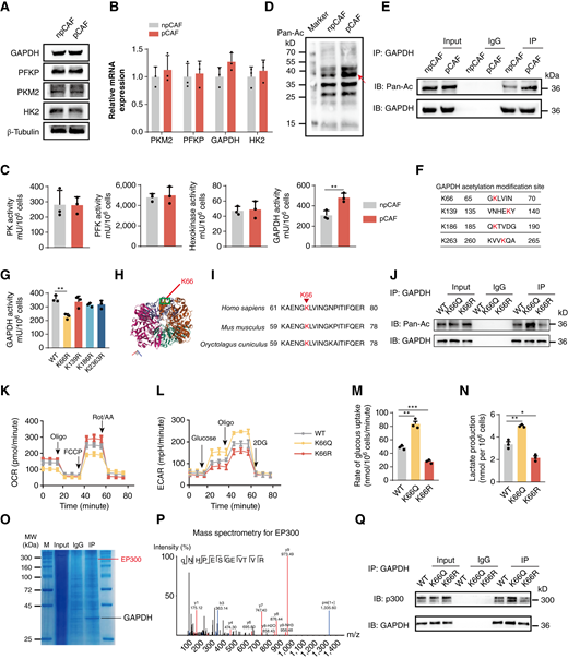 GAPDH acetylation regulates metabolic reprogramming in pCAFs. A, Western blot of the expression of GAPDH, PFKP, PKM2, and HK2 in npCAF or pCAF. B, qRT–PCR analysis of GAPDH, PFKP, PKM2, and HK2 in npCAF or pCAF. C, The enzyme activity of pyruvate kinase (PK), phosphofructokinase (PFK), hexokinase, and GAPDH in npCAF or pCAF. D, Pan-acetylation level was analyzed by immunoblotting with an anti-acetyl lysine antibody. E, An immunoprecipitation blot showing the GAPDH acetylation level, using a GAPDH antibody in vitro. F, The GAPDH acetylation modification site (red). G, The enzymatic activities of GAPDH variants (K66R, K139R, K186R, K263R) in vitro, with lysine (K) at positions 66, 139, 186, or 263 with arginine (R) to simulate a nonacetylated state. H, Three-dimensional stereostructure of GAPDH, with the green box representing K66. I, The K66 site in GAPDH is conserved across species. Alignment shows lysine residues corresponding to human GAPDH K66, highlighted in red. J, Effect of different GAPDH K66 mutations on acetylation levels. K66Q indicates that the lysine at position 66 is substituted by glutamine. K66R indicates that the lysine at position 66 is substituted by arginine. K–N, Effects of GAPDH K66 on aerobic glycolysis. The GAPDH K66 wild-type or K66-mutant pCAFs were assessed for oxygen consumption rate (OCR) as an indicator of oxidative phosphorylation and deduced levels of basal respiration and ATP production (K). Rot/AA, combination of rotenone and antimycin A. The ECAR was used to assess glycolytic flux and glycolytic capacity (L). The rate of glucose uptake (M) and lactate production (N) were analyzed in GAPDH K66 WT or K66-mutant pCAF. O, Representative Coomassie Aram staining image of GAPDH-associated proteins in pCAFs. The red line indicates the bands corresponding to distinct proteins enriched by GAPDH that were analyzed by LC-MS. P, MS identification of GAPDH-binding proteins. Q, The in vitro interactions of P300 and GAPDH were detected by immunoprecipitation. *, P < 0.05; **, P < 0.01; ***, P < 0.001.