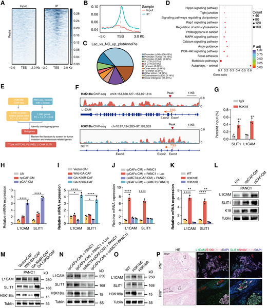 H3K18la activates L1CAM and SLIT1 transcription in pancreatic cancer. A and B, Distribution of H3K18la sites relative to the translation start site (TSS). C, The pie diagram shows the genomic occupancy of H3K18 binding sites as revealed by ChIP-seq in PANC1 cells. D, KEGG analysis of H3K18la peaks. E, Bioinformatics analysis filtered L1CAM and SLIT1 as downstream targets of H3K18la. F, Integrative Genomics Viewer tracks for L1CAM and SLIT1 from ChIP-seq analysis; peaks are marked with red triangles. G, ChIP-qPCR assay of H3K18la status in the L1CAM and SLIT1 genomic region in PANC1 cells (n = 3 independent experiments; independent samples t test; data are shown as the means ± SD). H–K, qRT–PCR analysis of L1CAM and SLIT1 mRNA in PANC1 cells and PANC1 cells subjected to specific treatments as described previously (n = 3 independent experiments; one-way ANOVA test; data are shown as the means ± SD). L–O, Western blot of L1CAM and SLIT1 in PANC1 cells and PANC1 cells subjected to specific treatments as described previously. P, mIF staining analysis of L1CAM and SLIT1 in PNI+ and PNI− PDAC tissues. S100 was used as a neuron marker, and CK19 was used as a tumor marker. Scale bars, 200 μm. *, P < 0.05; **, P < 0.01; ****, P < 0.0001.