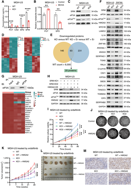 SRM depletion enhances erdafitinib efficacy via HMGA2. A, Intracellular polyamine metabolites levels measured by HPLC of WT and SRM KO MGH-U3 cells. CAD, cadaverine; SPM, spermine. B, Intracellular putrescine (PUT) and spermidine (SPD) levels measured by ELISA of MGH-U3 cells treated with 10 μmol/L MCHA or DMSO for 96 hours. C, Western blotting with the indicated antibodies in WT and SRM KO MGH-U3 cells. GAPDH was used as an internal control. D, Heatmap depicting the differentially expressed proteins between WT and SRM KO cells (left) or WT and SRM KO cells treated with 100 nmol/L erdafitinib for 96 hours (P < 0.005; right). Each group contained three independent replicates. Scale bar, log2-fold change. E, Venn diagram showing the lapping of the downregulated collection in group as depicted in D. Analysis pipeline was performed to identify proteins regulated by SRM KO: (i) 93 proteins were identified after overlapping; (ii) 20 proteins were selected with high abundance (WT count >6,000). Er, erdafitinib. F, Western blotting with the indicated antibodies in WT and SRM KO MGH-U3 or SW780 cells. GAPDH was used as an internal control. G, RIP assays in MGH-U3 cells using eIF5A and IgG antibody. The precipitate was subjected to Western blotting with the antibody against eIF5A. The eIF5A-enriched mRNAs relative to the IgG-enriched value was calculated by qRT-PCR. Scale bar, fold change. H, Western blotting with the indicated antibodies in WT and SRM KO MGH-U3 cells and those transfected with scramble or HMGA2. GAPDH was used as an internal control. I, Cell Counting Kit-8 assay revealed the cell viability of WT and SRM KO MGH-U3 cells and those transfected with scramble or HMGA2 treated with 100 nmol/L erdafitinib. J, Colony formation assay in the indicated MGH-U3 cells with erdafitinib treatment. K and L,In vivo growth curve (K) and representative of xenograft tumors (L) formed by subcutaneous injection of WT and SRM KO MGH-U3 cells and those transfected with HMGA2 into the right flanks of nude mice treated with erdafitinib (15 mg/kg; 5 × 106 cells per mouse; n = 6 for each group). M, IHC staining of Ki67 on WT and SRM KO MGH-U3 xenografts treated as in K. Scale bar, 50 μm. Data are presented as the means ± SD from three independent experiments. **, P < 0.01; ***, P < 0.001; ****, P < 0.0001 (Student t test). 