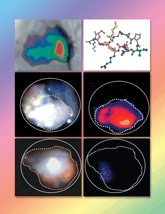 Cancer Research Cover Image for Volume 64, Issue 17