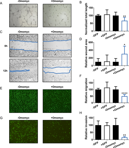 Omomyc impairs the capacity of MDA-MB-231 cells to induce angiogenesis and reduces their metastatic potential in vitro. A, Representative images of HUVECs 6 hours after addition of conditioned media from MDA-MB-231-Omomyc cells untreated (−Omomyc) or treated for 3 days with 0.6 μg/mL doxycycline (+Omomyc). B, Quantification of total tube length in HUVECs from A and in HUVEC cells treated with conditioned media from control MDA-MB-231-GFP cells under the same conditions. Graph shows mean + SD; statistical significance was determined by two-tailed unpaired t test. C, Representative images of a wound-healing assay of MDA-MB-231-Omomyc cells at 0 hours (onset) and 12 hours (endpoint) after treatment with 0.6 μg/mL doxycycline (+Omomyc) or left untreated (−Omomyc). The approximate area of the wound is delimited by a blue line. D, Quantification of the relative wound area from C at endpoint and from control MDA-MB-231-GFP cells under the same conditions, corrected for the total cell number. Graph shows mean + SD; statistical significance was determined by two-tailed Mann–Whitney test. E, Representative images of fluorescently labeled MDA-MB-231-Omomyc cells after 24 hours of migration through and FBS gradient. Cells were plated on top of a Boyden chamber in 0.5% FBS with (+Omomyc) or without (−Omomyc) 0.6 μg/mL doxycycline and migrated through a porous membrane toward wells containing 10% FBS. F, Quantification of migrated cells from E and from control MDA-MB-231-GFP cells under the same conditions, corrected for the total cell number. Graph shows mean + SD; statistical significance was determined by two-tailed unpaired t test. G, Representative images of fluorescently labeled MDA-MB-231-Omomyc cells after 24 hours of invasion through and FBS gradient. Cells were plated on top of a Matrigel-coated Boyden chamber in 0.5% FBS with (+Omomyc) or without (−Omomyc) 0.6 μg/mL doxycycline and migrated through a porous membrane toward wells containing 10% FBS. H, Quantification of invaded cells from G and from control MDA-MB-231-GFP cells under the same conditions, corrected for the total cell number. Graph shows mean + SD; statistical significance was determined by two-tailed unpaired t test.