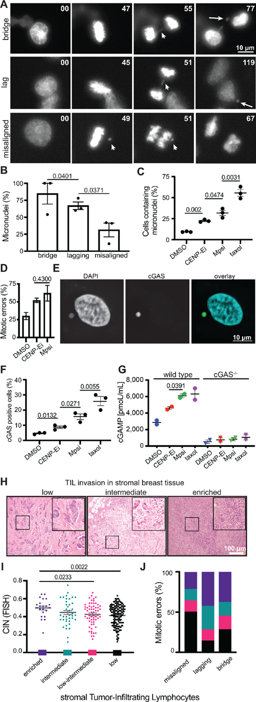 Misaligned chromosomes result in fewer micronuclei and less immune activation than other mitotic defects. Still images from 24-hour timelapse analysis at 2-minute intervals of Cal51 cells with endogenously labeled histone-H2B and EGFP-α-tubulin showing the most common fate of chromosome bridges (top, arrow), lagging chromosomes (middle, arrow), and misaligned chromosomes (bottom, arrows). Long arrows in far right panels indicate micronuclei. B, Frequency of micronucleus formation in daughter cells following each mitotic defect. C, Cells containing micronuclei after chemical induction of misaligned chromosomes with 50 nmol/L of the CENP-E inhibitor GSK923296, or lagging or bridge chromosomes due to 50 nmol/L of the Mps1 inhibitor reversine. A total of 10 nmol/L taxol was used as a positive control to generate micronucleated and multinucleated daughter cells. B and C,n > 125 cells per condition in each of three independent replicates. D, Frequency of mitotic defects induced by GSK (misaligned chromosomes that persist until anaphase onset) and reversine (lagging and bridge chromosomes). n = 15–20 mitotic cells per condition in each of three independent movies. E, Image of cGAS positive micronucleus. F, cGAS positive cells 48 hours after indicated treatment. n >125 cells in each of three independent replicates. Taxol was used as a positive control (51). G, ELISA quantification of 2′3′-cGAMP in cells following 48-hour treatment in parental wild type and CRISPR edited cGAS knockout MDA-MB-231 cells. H, Representative images of stromal TIL infiltration. I, CIN positively correlates with sTIL enrichment. ANOVA P value = 0.0154. sTIL scores: low <10%, low-intermediate 10%–20%, intermediate 20%–40%, enriched >40%. J, Frequency of sTIL infiltration categories in tumors delineated by mitotic defect. Tumors with misaligned chromosomes most frequently have low sTILs while tumors with lagging and bridge chromosomes are most frequently enriched. The specified mitotic errors occur in 0%–20% of tumor cells. P < 0.001, χ2 test. Other P values derived from unpaired t test.