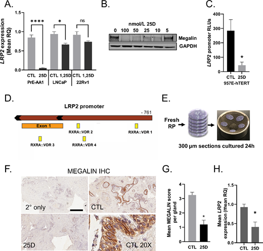 Negative regulation of LRP2 and megalin proteins by vitamin D in prostate cells and tissue slice explants. A,LRP2 expression following 24 hours of treatment with 50 nmol/L 25D in PrE-AA1, 50 nmol/L 1,25D in LNCaP and 50 nmol/L 1,25D in 22Rv1 cells. B, Immunoblot for megalin after 48 hours of 25D treatment of PrE-AA1 cells. C, Activity of a custom LRP2 promoter luciferase construct after 24 hours of 50 nmol/L 25D treatment in 975E-hTERT cells; RLU, relative luciferase units normalized to the transfection control. D,LRP2 promoter contains the RXR:VDR binding motifs. E,Ex vivo prostate tissue slice workflow. F, Images and quantification of megalin protein by IHC (G) and LRP2 gene expression in tissue slices (H) after 24 hours of treatment with 50 nmol/L 25D. Scale bar, 150 μm. The graph shows the mean pathologist score per gland. Graphs represent the mean ± SEM from triplicate experiments. For tissue slices, graphs show the representative experimental mean ± SD with two replicates per experiment. P values were determined using an unpaired t test.