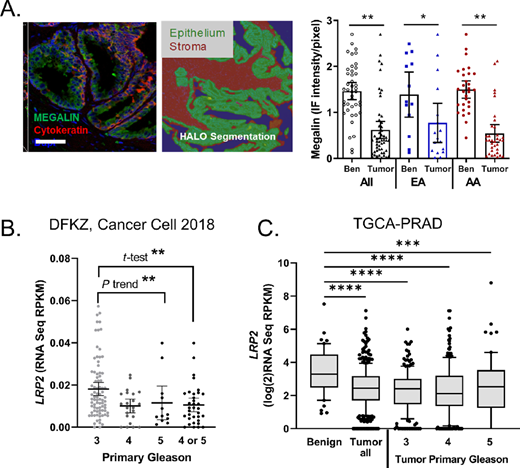 Megalin expression is dysregulated in cancer and lower with disease aggressiveness. A, Digital quantitation of epithelial megalin expression on a TMA consisting of 118 prostate biopsy cores from 29 patients (EA, n = 9; AA, n = 20). Epithelial regions were segmented by panCK staining, and benign and cancer regions were determined by a board-certified pathologist. Scale bar, 100 μm. Immunofluorescence (IF) intensity per pixel for megalin expressed as mean ± SEM; Ben, benign. B,LRP2 expression in RNAseq dataset of primary prostate cancer tumors by primary Gleason grade from Gerhauser and colleagues DHFZ dataset. Analyses by Gleason was ANOVA with Fisher multicomparisons for Gleason 3 (n = 82) and 4 (n = 24) or 5 (n = 12) combined. C,LRP2 expression in TCGA-PRAD RNAseq dataset with normal (n = 52) and tumor (n = 374) with breakdown by primary Gleason grade (Gleason 3 n = 206, Gleason 4 n = 249, Gleason 5 n = 63). ANOVA with Fisher multicomparisons test. *, P < 0.01; **, P < 0.001; ***, P < 0.001; ****, P < 0.0001.