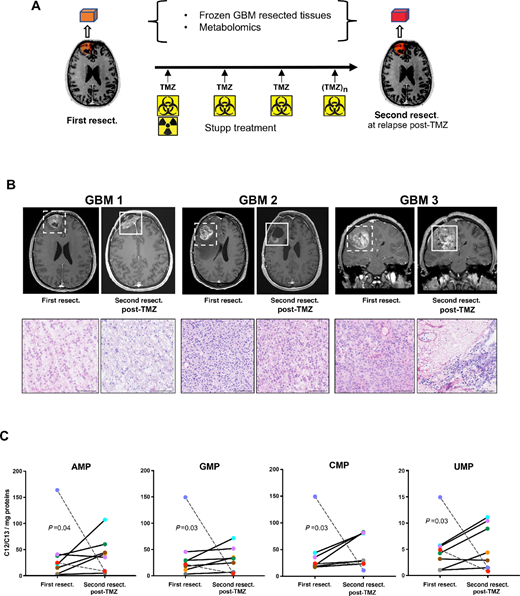 Metabolomics analysis of resected GBM from patients, pre- and post-TMZ treatment shows increased nucleotides concentrations. A, Metabolomics analysis were performed on GBM resected tumors from 8 patients, before treatment and after radiotherapy and several cycles (3 to 13) of TMZ treatment. B, MRI profiles and H&E-stained tissue sections of the analyzed GBM tumors, before and after TMZ treatment. Tumor areas at first and second resections are framed. Scale bar, 100 μm. C, Mass spectrometry metabolomics analysis of the resected GBM. The C12/C13 metabolite ratios normalized to tissue protein concentrations are indicated. Out of the 8 patients, 6 followed a similar trend (solid lines), while 2 followed an opposite trend (dotted lines). Statistical analysis by ratio paired Student t test (AMP, GMP, UMP) and Wilcoxon matched-pairs signed-rank test (CMP) on metabolomics data from the 6 patients.