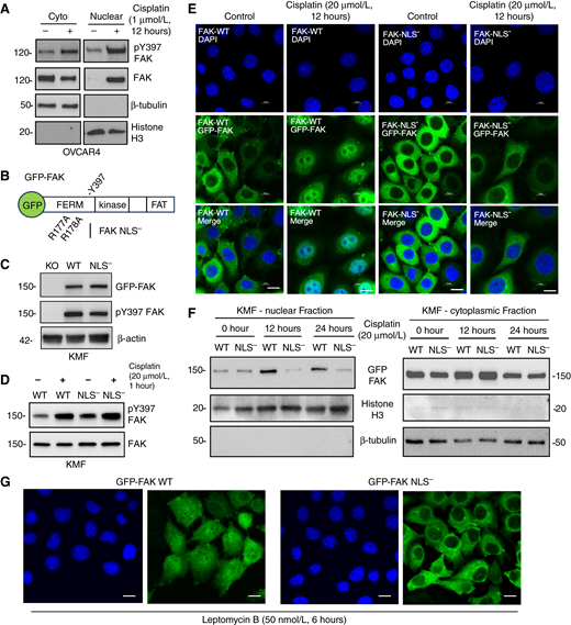 Nuclear FAK accumulation occurs upon cisplatin treatment of human and murine ovarian tumor cells. A, Nuclear and cytoplasmic cell fractionation of human OVCAR4 cells treated with DMSO (control) or cisplatin (1 μmol/L) for 12 hours followed by immunoblotting for FAK pY397, total FAK, β-tubulin (cytoplasmic marker), and histone H3 (nuclear marker). B, Schematic of GFP fusion to FAK denoting N-terminal band 4.1, ezrin, radixin, moesin homology (FERM), kinase, and focal adhesion targeting (FAT) domains. FAK FERM arginine R177 and R178 to alanine mutational changes prevent FAK nuclear localization. C, Stable reexpression of GFP-FAK-WT (WT) and GFP-FAK-NLS− (NLS−) in KMF FAK KO murine ovarian tumor cells as analyzed by FAK, pY397 FAK, and β-actin immunoblotting. D, KMF FAK-WT and KMF FAK-NLS− cells treated with DMSO (control) or cisplatin (20 μmol/L) for 1 hour and immunoblotting for FAK pY397 and total FAK. E, Confocal immunofluorescence imaging was used to visualize GFP-FAK and DAPI stain in FAK-WT and FAK-NLS− cells treated with DMSO (control) or cisplatin (20 μmol/L) for 12 hours. Shown are representative images of GFP-FAK (images shown at midline of Z-stack), nucleus, and merged images. Scale bar, 10 μm. F, Nuclear and cytoplasmic fractionation of FAK-WT and FAK-NLS− cells treated with cisplatin (20 μmol/L) for 0, 12, or 24 hours followed by immunoblotting for FAK, β-tubulin, and histone H3. G, Representative images of GFP-FAK-WT and FAK-NLS− expressing (images shown at midline of Z-stack) and DAPI-stained cells treated with leptomycin B (50 nmol/L) for 6 hours. Scale bar, 10 μm. Cyto, cytoplasmic.