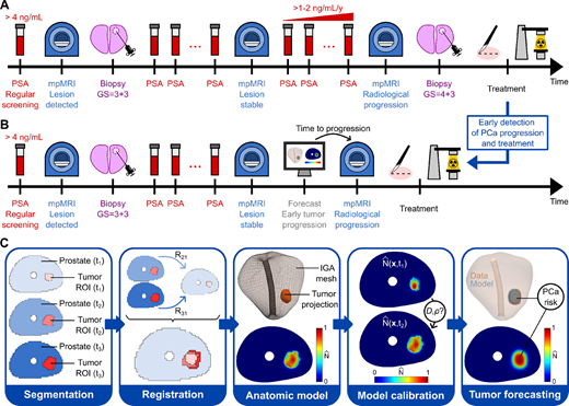 Imaging-informed computational pipeline for tumor forecasting to support clinical decision-making in AS for prostate cancer. A, Standard-of-care AS protocol for an illustrative patient. Following the detection of a serum PSA level moderately larger than 4 ng/mL, the patient undergoes an initial mpMRI scan that finds an organ-confined cancerous lesion. This radiological lesion is then confirmed as prostate cancer with GS = 3 + 3 in an ensuing biopsy. Because the prostate cancer risk is low, the patient enrolls in AS and periodic PSA tests are performed until the date of the next mpMRI scan in the AS protocol. This second imaging session does not reveal progression in the lesion, so the AS monitoring plan remains unchanged. However, the patient starts exhibiting a fast increase in PSA, which motivates an earlier imaging session before the originally prescribed date according to the AS protocol. This third mpMRI scan reveals radiological progression, which is further confirmed histopathologically as an upgrade to GS = 4 + 3 in an ensuing biopsy. At this point, the patient is offered a radical treatment for prostate cancer, which usually consists of surgery (i.e., radical prostatectomy) or radiotherapy (e.g., external beam radiotherapy, brachytherapy). B, Changes to the standard-of-care AS protocol after implementing the computational tumor forecasting pipeline presented in this study. The modified protocol is identical to the standard of care up to the second mpMRI. At this point, the longitudinal imaging data collected for the patient can be used to personalize our biomechanistic model of prostate cancer growth and obtain a computational forecast of prostate cancer growth over the patient's prostate anatomy. The forecast reveals progression toward high-risk prostate cancer and provides the time up to this event. This prediction enables optimizing the timing of the third mpMRI to confirm progression and proceed to treatment. Thus, our approach avoids PSA testing and biopsy after the second mpMRI, provides a personalized prediction of the patient's prostate cancer progression that enables an early detection of this event, and supports the decision and optimal timing to perform treatment. C, Main steps in our computational pipeline for prostate cancer forecasting during AS. In the cohort of this study (n = 7), all patients had three mpMRI scans. We first analyze the ability of our model to represent patient-specific prostate cancer growth after being informed by three mpMRI scans. Then, we also investigate the ability of our model to forecast prostate cancer growth when informed by only the first two mpMRI scans, and we use the third one to assess the predictive performance of the model. The first step of the computational pipeline is segmentation. We delineate the prostate and the tumor region of interest (ROI) on the longitudinal mpMRI data collected for the patient. After segmentation, the second and third mpMRI datasets and segments are co-registered with a nonrigid elastic method to the first one (registration transforms R21 and R31, respectively). Next, we build a virtual model of the prostate anatomy, consisting of a 3D isogeometric (IGA) mesh and we project the registered tumor ROIs onto it. Then, we map the ADC values within each tumor ROI to tumor cell density values, which are subsequently used to guide model calibration and determine the personalized model parameters. Finally, we perform a patient-specific tumor forecast, including the prediction of tumor volume, tumor cell density map, and prostate cancer risk.