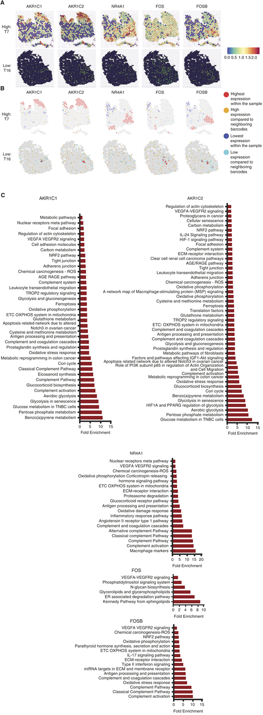 Spatial genomics uncovers hotspots of transcriptomic changes associated with glucocorticoid receptor signaling. A, Visualization of spatial gene expression of key genes correlated with the neighborhood violent crime rate in representative tumor samples from high and low-violence neighborhoods. Spatial expression was visualized in Seurat. B, Hot spot analysis of key genes correlated with the violent crime rate in representative tumor samples from high and low-violence neighborhoods. Hotspots were identified using the univariate local Moran’s test. Darker colors denote a P-value of <0.01 and lighter colors indicate a P-value of <0.05. C, Pathway analysis of genes differentially expressed within P < 0.01 highest expression within the sample hotspots. Differential gene expression analysis was performed using FindMarkers in Seurat, and genes with a non-adjusted P-value of <0.05 were used for pathway analysis. Analysis of pathways with a P-value of <0.05 was performed in DAVID using Biocarta, Kegg, and Wikipathways analysis.