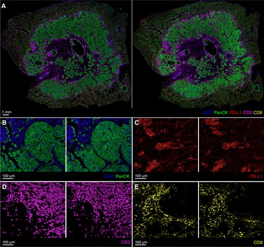 A, Example of real (left) and virtual (right) stains showing the WSI composite for all mIF stains. B–E, Examples of real (left) and virtual (right) stains from the individual models for DAPI + PanCK, PD-L1, CD3, and CD8 at several regions across the WSI.