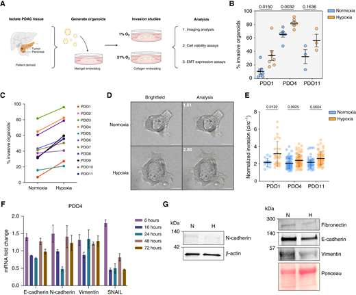 Hypoxia increases invasion in patient-derived PDAC organoids. A, Schematic of PDAC organoid culture generation, collection, study, and analysis timeline. B, Effect of hypoxia on invasion in PDO1, PDO4, and PDO11 organoids. Percent invasion represents a mean of minimum three biological replicates with SD. Each biological replicate n > 30 organoids (P = 0.015, P = 0.0032, and P = 0.1636, respectively, t test). C, Fold change of PDAC PDO sample invasion in normoxia and hypoxia. D, Representative images of PDO4 invasive organoids in normoxia and hypoxia. Scale bars, 100 μm. E, Inverse circularity scores of normoxic and hypoxic PDO1 (n = 15 and n = 29, respectively; P = 0.0122, t test), PDO4 (both n = 71; P = 0.0025, t test), and PDO11 (n = 44 and n = 54, respectively; P = 0.0024, t test) invasive organoids. F, Expression level of EMT markers (E-cadherin, N-cadherin, vimentin, and SNAIL) in PDO4 measured by qRT-PCR at multiple time points. Fold changes, expressed relative to normoxic control samples, represent a mean of three technical replicates with SD. G, Western blot analysis of EMT markers (fibronectin, E-cadherin, N-cadherin, and vimentin) in PDO4 in normoxia and hypoxia. H, hypoxia; N, normoxia.