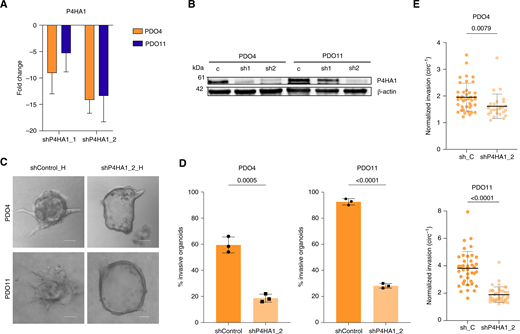 Knockdown of P4HA1 decreases invasion in PDAC PDOs in hypoxia. A, Expression level of P4HA1 measured by qRT-PCR. Fold changes, expressed relative to the modified control samples, represent a mean of three technical replicates with SDs (PDO4 P = 0.0547, t test; PDO6 P = 0.0816, t test). B, Western blot analysis to confirm effectiveness of P4HA1 knockdown in PDO4 and PDO11 compared with the empty vector. C, Representative images of invasive shControl and shP4HA1_2-modified organoids in hypoxia. Scale bars, 100 μm. D, Effect of P4HA1 knockdown on invasion in modified PDO4 and PDO11 organoids. Percent invasion represents a mean of three biological replicates with SDs. Each biological replicate n > 30 organoids. (P = 0.0005 and P < 0.0001, t test). E, Inverse circularity scores of empty vector–modified and P4HA1 knockdown–modified PDO4 (top; n = 41 and n = 27, respectively; P = 0.0079, t test) and PDO11 (down; both n = 40; P < 0.0001, t test) organoids in hypoxia.