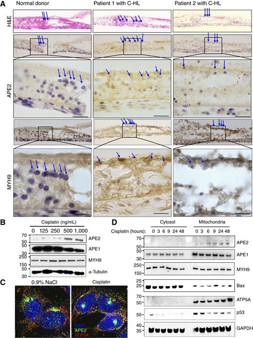 Cisplatin treatment results in APE2 upregulation and mitochondrial dysmorphology in cochlear hair cells. A, IHC analysis of APE2 and MYH9 expression in cochlear tissues from patients with C-HL (n = 2) and normal donors (n = 1). OHCs are highlighted using blue arrow heads. Scale bar, 50 μm. B, Immunoblot analysis of APE1, APE2, and MYH9 expression in HEI-OC1 cells after 24 hours of cisplatin treatment at indicated concentrations. C, Z-stack compressed images of HEI-OC1 cells treated with 1,000 ng/mL cisplatin for 6 hours at indicated concentrations, showing 4',6-diamidino-2-phenylindole (DAPI) (blue), APE2 (green), and ATP5A/mitochondria (red). D, Immunoblot of subcellular cytosolic and mitochondrial protein fractions of HEI-OC1 cells after treatment with 1,000 ng/mL cisplatin for indicated times. ATP5A mitochondrial marker is shown. The experiments shown in B–D were performed independently 3 times (n = 3) with consistent results. Representative data from one experiment are presented. H&E, hematoxylin and eosin.
