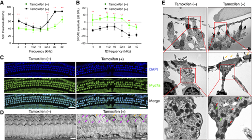 Clinical features of C-HL–like disease in APE2 transgenic mice. A, ABR thresholds, (B) DPOAE amplitudes, and (C) immunofluorescence staining (scale bar, 50 μm). D, Scanning electron microscopy (scale bar, 10 μm) in Prestin-ERT2Cre+/−hAPE2LSL/− mice (n = 6) before and after injection with tamoxifen to induce APE2 overexpression. In the tamoxifen (−) group, OHCs exhibit a well-organized, intact structure, with preserved stereocilia and uniform surface morphology. In contrast, the tamoxifen (+) group shows widespread OHC degeneration, characterized by disorganized cell arrangement and significant OHC loss, as indicated by pink arrows. The damaged regions exhibit surface collapse and stereocilia disintegration (orange arrows), suggesting progressive OHC degeneration. E, TEM study of the mitochondria and the stereocilia of OHCs from 8-week-old hAPE2LSL/−Prestin-CreERT2+/− mice (n = 3). Tamoxifen was injected in 3-week-old mice (scale bar, 10 μm). In the tamoxifen (−) group, mitochondria appear intact, exhibiting a uniform shape and electron density, indicative of normal mitochondrial function. The cytoplasmic texture remains uninterrupted, with a lack of autophagic vesicles, suggesting no active mitophagy. In contrast, the tamoxifen (+) group shows increased mitochondrial fragmentation, characterized by small, irregularly shaped mitochondria (red arrows), a hallmark of mitophagy. Additionally, the presence of electron-dense autophagic vesicles near mitochondria suggests the formation of mitophagosomes (green arrows), further supporting active mitochondrial degradation in response to APE2 overexpression. Loss of stereocilia (orange arrows), with remaining structures appearing shortened and disorganized, indicative of sensory dysfunction. *, P < 0.05; **, P < 0.01.