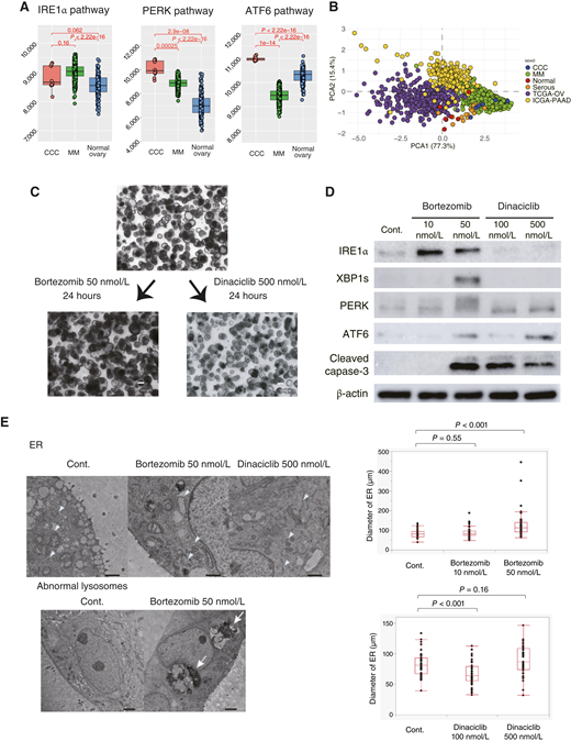The activation of the UPR in CCC, with a higher level of activation observed following treatment with bortezomib. A, GSEA of the IRE1α pathway, PERK pathway, and ATF6 pathway in CCC, multiple myeloma from TCGA, and normal ovary from the Genotype-Tissue Expression database. B, PCA of ssGSEA using ATF6, IRE1α, and PERK pathways. TCGA-OV, TCGA ovarian cancer; TCGA-PAAD, TCGA pancreatic adenocarcinoma. C, Bright-field image of CCC organoid (19-042) treated with bortezomib (50 nmol/L, 24 hours) or dinaciclib (500 nmol/L, 24 hours). D, Immunoblot analysis of UPR markers (IRE1α, XBP1s, PERK, and ATF6) and an apoptosis marker (cleaved caspase-3) following treatment with bortezomib (10 or 50 nmol/L, 24 hours) or dinaciclib (100 or 500 nmol/L, 24 hours). E, TEM images after treatment with bortezomib (50 nmol/L, 24 hours) or dinaciclib (500 nmol/L, 24 hours). The arrowhead indicates the ER. Bortezomib treatment at 50 nmol/L significantly induced ER lumen dilatation (P < 0.001), whereas dinaciclib treatment did not. The arrow indicates the abnormal lysosome. Scale bars, 1 μm (top) and 2 μm (bottom). MM, multiple myeloma.