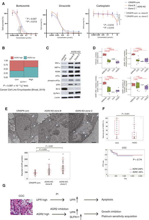 AGR2 knockout sensitizes CCC organoids to carboplatin through upregulation of SLFN11 and induces UPR and ER stress. A, Dose–response curve of bortezomib, dinaciclib, and carboplatin in AGR2-KO organoids. AGR2-KO organoids showed increased sensitivity to bortezomib (P = 0.007 and 0.012) and carboplatin (both P = 0.010) but not to dinaciclib. B, Correlation between AGR2 and SLFN11 mRNA in the Cancer Cell Line Encyclopedia dataset (Broad, 2019; ref. 52). AGR2 expression was significantly related to low SLFN11 expression (P = 5.087 × 10−14). C, Immunoblot analysis of UPR pathway genes and SLFN11 in AGR2-KO CCC organoids. D, Activation of the UPR pathway in AGR2-KO CCC organoids (Hallmark_unfolded_protein_response, P = 0.0022; GOBP_ATF6_mediated_ unfolded_protein_response, P = 0.00012; GOBP_IRE1_mediated_unfolded_protein_response, P = 0.00073; and GOBP_regulation_of_PERK_mediated_unfolded_protein_response, P = 0.76, compared with the control). E, TEM images the of AGR2-KO CCC organoid. The arrowhead indicates the ER. AGR2 knockout showed significant ER lumen dilatation (clone B, P < 0.001 and clone C, P < 0.001). F, Higher AGR2 expression in CCC (n = 51) than in HGSC (n = 43; P < 0.001). AGR2 expression was not correlated with progression-free survival in CCC (P = 0.74). G, Schematic representation of the identified mechanisms in this study. CCC exhibits high UPR, which is further upregulated by PIs to induce apoptosis. There are many AGR2-high CCCs, and AGR2 inhibition upregulates UPR and SLFN11 expression, leading to growth inhibition and platinum sensitivity.