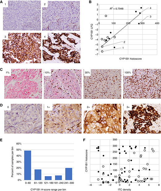 Validation of CYP1B1 as a biomarker of chemotherapy resistance in TNBC. A, CYP1B1 staining with ab185954 of two pCR+ MS cohort patients (1, 2) and two pCR− MS cohort patients (3, 4). Images were obtained with a 20X objective. B, CYP1B1 histoscores (x-axis) vs. CYP1B1 quadruplicate mean LFQ values (y-axis) for the 16 patients in the MS cohort. White and black points represent pCR+ and pCR− patients, respectively. C, Multikeratin/CD3 double stains of representative TNBC with distinct ITC densities. Tumor cells and T cells are stained red and brown, respectively. Estimated ITC densities in the respective images are shown. Images were obtained with a 20X objective. D, CYP1B1 IHC stains of TNBC with negative (0), weak (1+), moderate (2+), and strong (3+) staining intensity in tumor cell cytoplasm. Images were obtained with a 40X objective. E, Histogram in which bins represent CYP1B1 histoscore groups (x-axis) versus percentage patient samples in each bin (y-axis). F, Distribution of log2 ITC density (x-axis) vs. CYP1B1 histoscore (y-axis) in 80 patients with TNBC. Patients associated with pCR+ and pCR− outcomes are colored white and black, respectively.