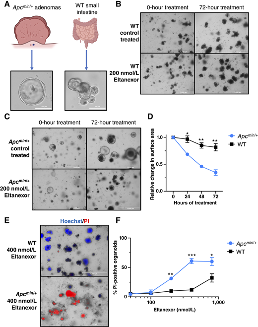 Eltanexor shows increased sensitivity to tumor-derived organoids compared with WT mouse small intestine organoids. A, Representative photos of Apcmin/+ tumor–derived (tumoroids) and WT mouse small intestinal tissue–derived organoids. B, Representative photos of WT organoids treated with 200 nmol/L eltanexor for 72 hours. C, Representative photos of tumoroids treated with 200 nmol/L eltanexor for 72 hours. D, Tumoroids and WT organoids were treated with a dosage of 200 nmol/L eltanexor over 72 hours. Every 24 hours, the relative change in the surface area of each population was determined in ImageJ. The relative change is normalized to each population’s average surface area at hour 0. Values represent the mean of three individual experiments ± SEM. At least 50 organoids were measured at each time point under each treatment condition. A Student t test was used to statistically compare relative changes in surface area at each time point between control-treat and eltanexor-treated groups. E, Representative photos of both organoid populations that were treated with 400 nmol/L eltanexor for 72 hours. After 72 hours, each population was stained with 10 μg/mL of Hoechst and 10 μg/mL of PI. The organoids experiencing cell death will stain with PI. F, Tumoroids and WT organoids were treated with DMSO or 50 nmol/L, 100 nmol/L, 200 nmol/L, 400 nmol/L, and 800 nmol/L eltanexor for 72 hours. At 72 hours, the organoids were stained with 10 μg/mL of Hoechst and 10 μg/mL of PI. The graph represents the percentage of organoids from each population that was stained with PI under the various eltanexor dosages. The values represent the mean of three individual experiments ± SEM. A Student t test was used to statistically compare % PI-positive organoids in each treatment group between control-treat and eltanexor-treated groups. (*, P ≤ 0.05; **, P ≤ 0.01; ***, P ≤ 0.001.)