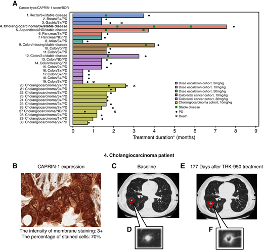 Duration of treatment and response with TRK-950 and representative antitumor activity in patients with cholangiocarcinoma. A, Duration of treatment and response with TRK-950. Each bar represents 1 patient. The length of the bar represents the duration of treatment with TRK-950. Treatment duration was defined as follows: (Date of Last Dose – Date of First Dose + 1), and was the period up to the date of the last dose. BOR, best overall response; ND, not detected; PD, progressive disease; missing, no samples to evaluate. B, Representative image of CAPRIN-1 expression in patients with cholangiocarcinoma. CAPRIN-1–IHC staining features observed in archival tumor specimens of cholangiocarcinoma. C–F, Representative antitumor activity in patients with cholangiocarcinoma. CT scans of the metastatic lung region for a patient receiving TRK-950 10 mg/kg. Images were taken (C and D) at baseline and (E and F) 177 days after TRK-950 treatment. D and F indicate enlarged regions.