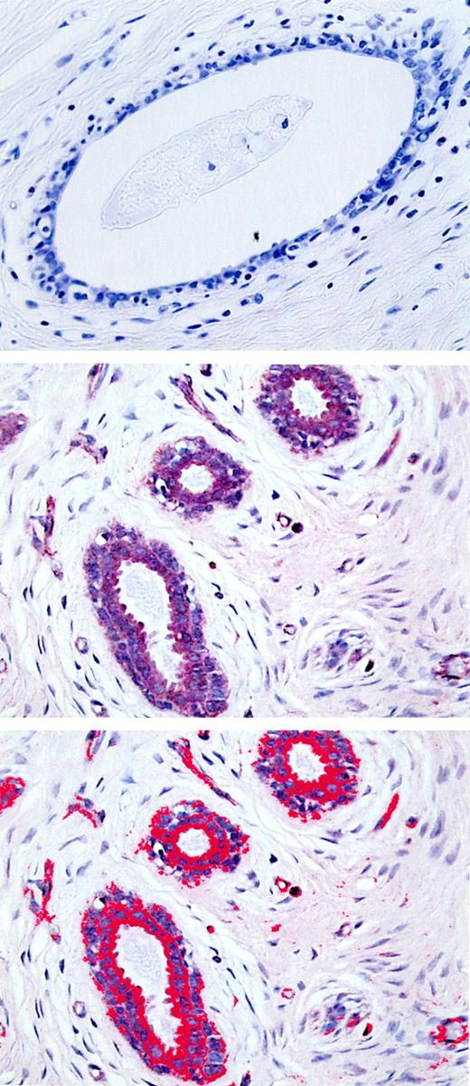 Fig. 1. Image analysis. Top, negative control for IGF-I staining; middle, IGF-I staining; bottom, IGF-I-stained area outlined in red by thresholding. All of the images are shown at ×40 magnification.