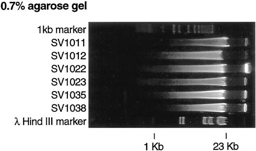 Fig. 2. The presence of linear low molecular weight DNA in samples extracted from human tissues using the Qiagen column purification system. Shown is DNA from six specimens (four mesotheliomas and two normal human lung specimens).