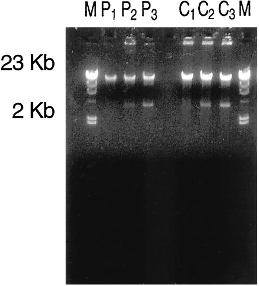Fig. A.1. Relative amount of low molecular weight DNA in WI-38 cell specimens supplemented with specified amounts of a low molecular weight plasmid (HB1/pCRII). See Appendix A and <$REFLINK> for the description of the specimens.