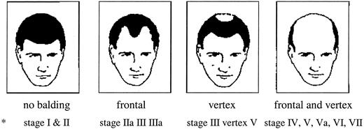 Fig. 1. Androgenetic alopecia patterns in men. ∗, adapted from the Hamilton-Norwood scale (19).