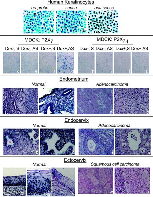 Figure 3. Expression of the P2X7 mRNA: in situ hybridization. a to c, cultures of normal human foreskin keratinocytes were either not hybridized (a), hybridized with the sense P2X7 probe (b), or hybridized with the antisense P2X7 probe (c). Nuclei were counterstained as described in Materials and Methods. Specific hybridization of the P2X7 probe in c is seen as intense blue perinuclear and cytoplasmic reaction with the anti-digoxigenin antibody. The experiment was repeated twice with similar trends. d to k, tetracycline repressor–expressing Madin-Darby canine kidney cells (MDCK) were transfected with either the P2X7 cDNA or the P2X7-j cDNA, grown in the absence (Dox−) or presence (Dox+) of doxycyline, and hybridized either with the sense P2X7 probe (S) or with the antisense P2X7 probe (AS). Nuclei were not stained. g, specific hybridization of the P2X7 probe was seen only in doxycyline-treated cells transfected with the P2X7 cDNA and hybridized with the antisense P2X7 probe. The experiment was repeated twice with similar trends. l to x, in situ hybridization with the antisense P2X7 probe of cross-sections of human endometrial (l-o), endocervical (p-s), and ectocervical (t, u, w, and x) tissues. l, m, p, q, and t to v, normal tissues; n, o, r, s, w, and x, cancer tissues. Magnification, ×4 (l, n, p, r, t, v, and w) or ×20 (m, o, q, s, u, and x). v, cross-section of the normal ectocervix hybridized with the sense P2X7 probe. l, m, p, q, t, and u, specific hybridization of the antisense P2X7 probe was seen in the epithelia of the normal tissues. The experiment was repeated three to five times with similar trends.