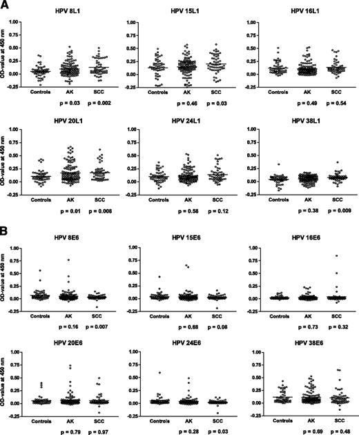 Figure 1. Seroreactivity against L1 viruslike particles (VLP; A) and GST-E6 proteins (B) of six HPV types, shown as absorbances measured in ELISA among controls, AK, and SCC patients. Horizontal bars, mean calculated absorbance values for each population. P < 0.05 was considered to be statistically significant (Student's t test).