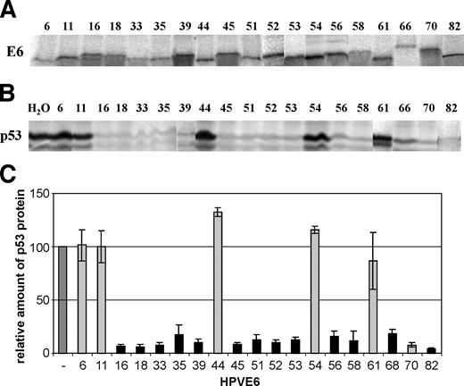 Figure 1. E6-mediated degradation of p53 in vitro. In vitro–translated p53 was incubated with in vitro–translated E6 protein of different HPV types or water-primed lysate (H2O) for 2 hours. A. Autoradiogram of representative translation reactions of HPV E6 proteins before adjustment for the in vitro p53 degradation assays. B. Autoradiogram of a representative degradation assay. C. Average relative amounts of p53 remaining after 2 hours of incubation, which were quantified by phosphorimaging. Data are relative to the water-primed control, which was set to 100%. Columns, average of at least three independent experiments; bars, SD. Epidemiologic classification according to Munoz et al. (4). Pale gray, low risk; black, high risk; dark gray, water-primed control reaction.