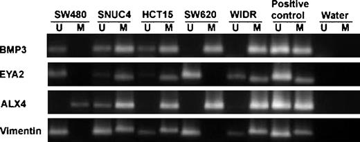 Figure 8. Methylation status of colon cancer cell lines checked with MSP. PCR products in lanes U or M indicates the presence of unmethylated or methylated genes, respectively. Universally methylated DNA and human genomic DNA were used as positive controls for methylation and unmethylation. Water was used as negative control.