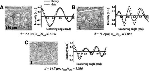 Figure 2. H&E-stained microscopy image (left, bar, 50 μm) and corresponding a/LCI ata, giving scattering as a function of angle, shown with best-fit theoretical distribution (right) for normal tissue (A), LGD (B), and HGD (C). The a/LCI determined nuclear morphology descriptor for each representative tissue type is given under each plot.