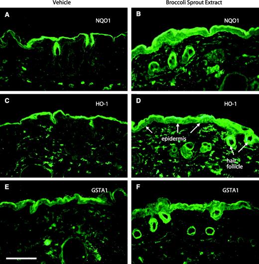 Figure 2. Immunohistochemical detection of phase 2 enzymes in mouse skin. Fresh frozen sections (10-μm thickness) of unfixed skin from areas that received a single dose of either vehicle or broccoli sprout extract containing the equivalent of 100 nmol sulforaphane/cm2 were prepared and immunostained with specific antibodies to detect protein levels of NQO1 (A and B), HO-1 (C and D), and GSTA1 (E and F). Bar, ∼100 μm.