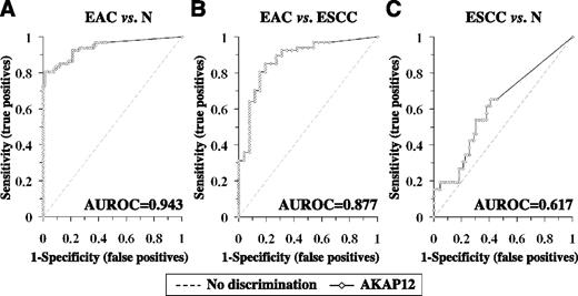 Figure 1. ROC curve analysis of NMV. ROC curve analysis of AKAP12 NMVs of normal esophagus (N) versus EAC (A), ESCC versus EAC (B), and N versus ESCC (C). The area under the ROC curve (AUROC) conveys this biomarker's accuracy in distinguishing EAC from normal specimens and from ESCC in terms of its sensitivity and specificity.