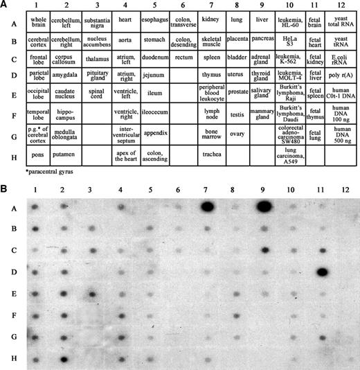 Figure 1. A. Detection of UK114 mRNA in human tissues. Representative human tissue and the internal control in the Human Multiple Tissue Expression (MTE) Array (Clontech), which in essence is an array of poly(A)+ for quickly profiling gene expression. B. Human Multiple Tissue Expression (MTE) Array was hybridized with a human UK114-specific cDNA probe to detect the expression of UK114 in the various normal human tissues. Hybridization signals were visualized by autoradiography.