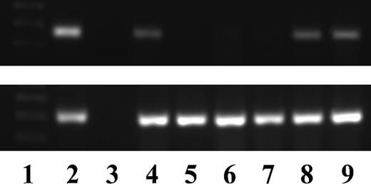Figure 1. PSMA mRNA by reverse transcription-PCR in cancer cell lines. Lane 1, marker; lane 2, LNCaP cell line (considered as positive control); lane 3, negative control (no template); lane 4, OVCA429 (ovarian cancer); lane 5, AN3CA (endometrial cancer); lane 6, HEC59 (endometrial cancer); lane 7, DU145 (prostate cancer); lane 8, PC3 (prostate cancer); lane 9, U3 (urothelial cancer).