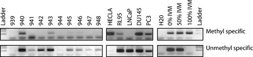Figure 4. PSMA MSP analysis in selected tumor samples and cell lines. Samples 940 and 943 showed methylated bands. Samples 941, 942, 947, and 948 are conclusively unmethylated. However, samples 939 and 944 were inconclusive. IVM, in vitro methylated DNA; 50% IVM, equal mixture of IVM DNA with nonmethylated DNA.