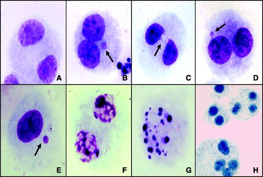 Figure 1. Representative images of cells scored using the CBMN Cyt assay: (A) normal binucleated cell, (B) binucleated cell with micronuclei, (C) binucleated cell with nucleoplasmic bridge, (D) binucleated cell with bud, (E) mononucleated cell with micronucleus, (F) cell in necrosis, (G) cell in apoptosis, and (H) polynucleated cells.
