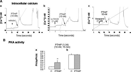 Figure 3. Effects of PTHrP(1-34) on intracellular calcium and PKA activity in H295R cells. A, a. Direct effects of 10 nmol/L of PTHrP on intracellular calcium. Cells were loaded for 30 min with 1 μmol/L of Fura-2/AM. The response profile is a peak followed by a plateau phase. b. Cells were incubated for 1 min with 1 μmol/L of U-73122, a direct inhibitor of PLC, before adding 10 nmol/L of PTHrP(1-34). c. Cells were incubated for 1 min with 1 μmol/L of verapamil, a calcium channel inhibitor, before adding 10 nmol/L of PTHrP(1-34). B. PKA activity: the PKA activity in H295R cells incubated for 15 min with PTHrP(1-34) (10 nmol/L; n = 3), and cells not incubated with PTHrP shown at time 0, without (a) and after exposure to cAMP (b). Cells exposed to PTHrP have a higher PKA activity than untreated cells (**, P < 0.001).