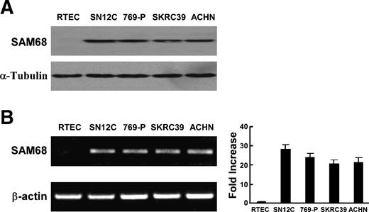 Figure 1. Expression of SAM68 protein and mRNA in normal human renal tubular epithelial cells and renal cell carcinoma cell lines analyzed by Western blotting (A), and RT-PCR and real-time RT-PCR (B). A. Expression of SAM68 protein in the normal human renal tubular epithelial cells and four cultured renal cell carcinoma cell lines, including 769-P, SN12C, SKRC-39, and ACHN, was determined by Western blotting. Expression levels were normalized with α-tubulin. B. Expression (left) and quantification (right) of SAM68 mRNA in the normal human renal tubular epithelial cells and four cultured renal cell carcinoma cell lines. Expression levels were normalized for GAPDH. Error bars, SD calculated from three parallel experiments.