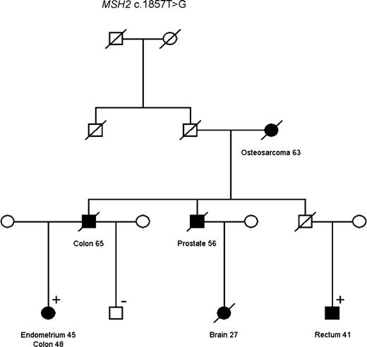 Figure 2. Individuals affected with cancer included in the Lynch syndrome are colored. Individuals that have tested positive and negative for the MMR mutation in the family are marked with “+” and “−,” respectively. The pedigrees have been altered (without altering the message of the article) to maintain confidentiality.