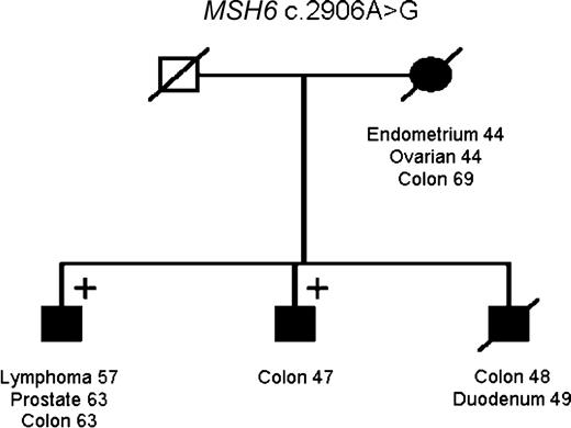 Figure 3. Individuals affected with cancer included in the Lynch syndrome are colored. Individuals that have tested positive and negative for the MMR mutation in the family are marked with “+” and “−,” respectively. The pedigrees have been altered (without altering the message of the article) to maintain confidentiality.