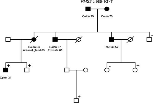 Figure 4. Individuals affected with cancer included in the Lynch syndrome are colored. Individuals that have tested positive and negative for the MMR mutation in the family are marked with “+” and “−,” respectively. The pedigrees have been altered (without altering the message of the article) to maintain confidentiality.