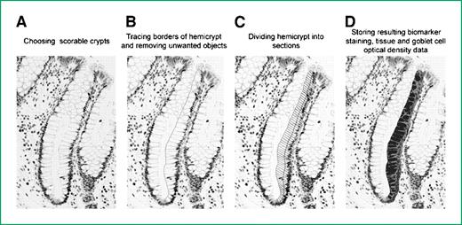 Figure 1. Quantitative image analysis using Aperio Scanscope and CellularEyes software to measure 8-OH-dG labeling in normal-appearing colorectal crypts. A. Choosing scorable crypts. B. Tracing borders of hemicrypt and removing unwanted objects. C. Dividing hemicrypt into sections. D. Storing resulting biomarker staining, tissue and goblet cell optical density data.