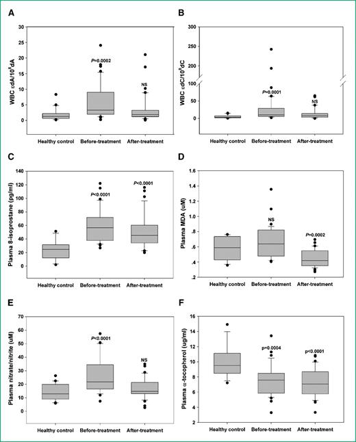 Figure 2. A-F. Levels in WBC DNA of ϵdA and ϵdC, plasma 8-isoprostane, malondialdehyde, nitrate/nitrite, and α-tocopherol in O. viverrini–infected patients (n = 50, before and 2 mo after treatment with praziquantel) and untreated, healthy control subjects (n = 20). P values were obtained from comparisons of O. viverrini–infected patients before and after treatment versus controls (Mann Whitney U test). Levels of WBC ϵdA (A), WBC ϵdC (B), plasma 8-isoprostane (C), plasma malondialdehyde (D), plasma nitrate/nitrite (E), and plasma α-tocopherol (F).