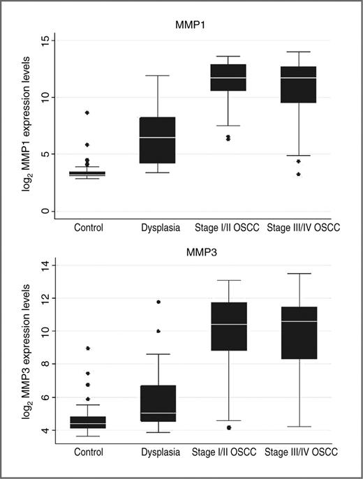 Figure 1. log2MMP1 and MMP3 expression levels across disease categories, University of Washington Affiliated Hospitals, 2003 to 2007. MMP1 and MMP3 mRNA expression levels were measured from Affymetrix microarray data, and are expressed as expression levels in the log2 scale. Plots are shown for expression levels in oral epithelium for: 45 controls, 17 dysplasia patients, 54 stage I/II invasive OSCC patients, and 111 stage III/IV invasive OSCC patients.