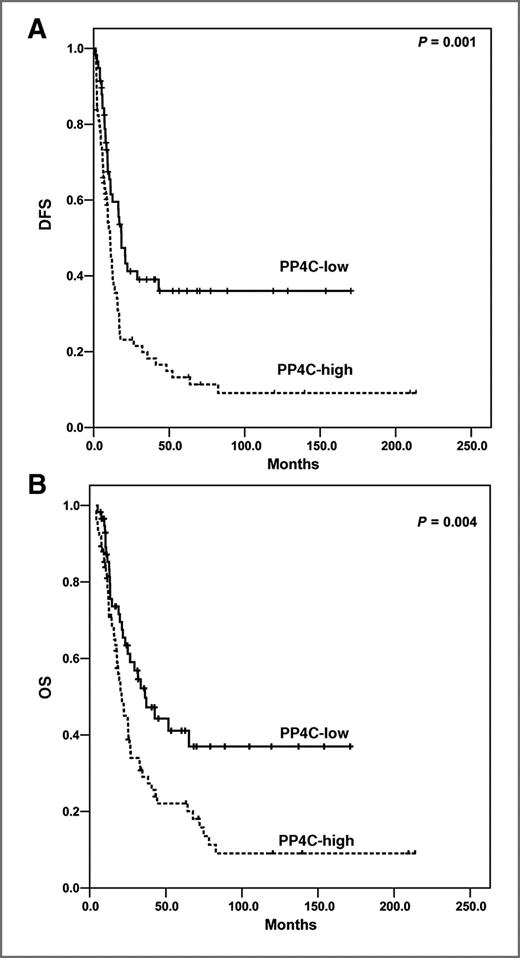 Figure 3. Kaplan–Meier curves for DFS (A) and OS (B) by PP4C expression levels in patients with stage II PDAC.